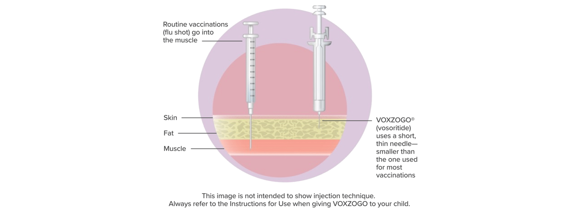 How VOXZOGO is given