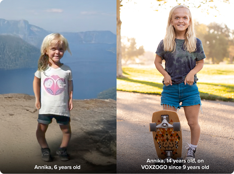 Annika, 6 years old, a child with achondroplasia before starting VOXZOGO treatment Annika, 14 years old, a teenager with achondroplasia who has experienced linear growth with VOXZOGO