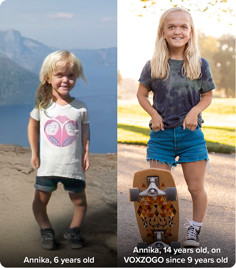 Annika, 6 years old, a child with achondroplasia before starting VOXZOGO treatment Annika, 14 years old, a teenager with achondroplasia who has experienced linear growth with VOXZOGO